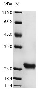 Greater than 85% as determined by SDS-PAGE.Recombinant Human Herpesvirus 6A Probable Ganciclovir Kinase (U69) Protein (His)