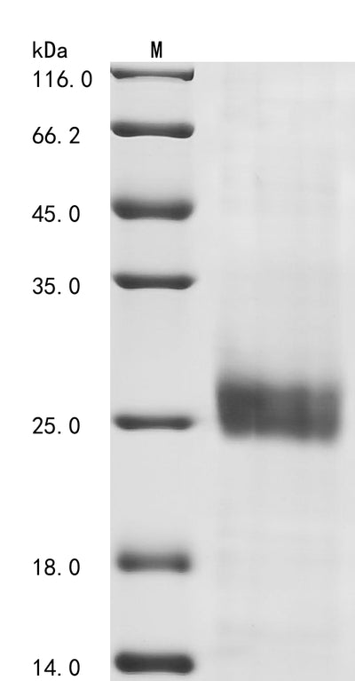 Greater than 85% as determined by SDS-PAGE.Recombinant Avian Infectious Bronchitis Virus Spike Glycoprotein (S) Protein (His)
