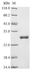 Greater than 90% as determined by SDS-PAGE.Recombinant Lake Victoria Marburgvirus Rna-Directed Rna Polymerase L (L) Protein (His&Myc)