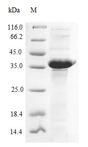 Greater than 85% as determined by SDS-PAGE.Recombinant Bacillus Subtilis Penicillin-Binding Protein 1A/1B (PONA) Protein (His-SUMO)