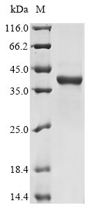 Greater than 85% as determined by SDS-PAGE.Recombinant Candida Albicans Candidapepsin-6 (SAP6) Protein (His)