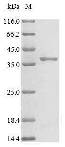 Greater than 85% as determined by SDS-PAGE.Recombinant Clostridium Perfringens Microbial Collagenase (COLA) Protein (His&Myc)