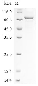Greater than 85% as determined by SDS-PAGE.Recombinant Sars-Cov-2 Spike Glycoprotein (S) Protein (His), Active