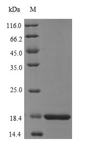 Greater than 90% as determined by SDS-PAGE.Recombinant Sars-Cov-2 Nucleoprotein (N) Protein (His)