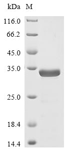 Greater than 85% as determined by SDS-PAGE.Recombinant Sars-Cov-2 Nucleoprotein (N) Protein (His)