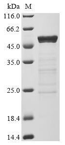 Greater than 83% as determined by SDS-PAGE.Recombinant Sars-Cov-2 Nucleoprotein (N) Protein (His), Active