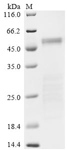 Greater than 85% as determined by SDS-PAGE.Recombinant Sars-Cov-2 Nucleoprotein (N) Protein (His)
