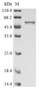 Greater than 85% as determined by SDS-PAGE.Recombinant Sars-Cov-2 Nucleoprotein (N) Protein (His), Active