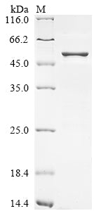 Greater than 85% as determined by SDS-PAGE.Recombinant SARS-CoV-2 Nucleoprotein (N) Protein (His)