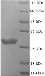 Greater than 90% as determined by SDS-PAGE.Recombinant Bovine Coronavirus Spike Glycoprotein (S) Protein (His)