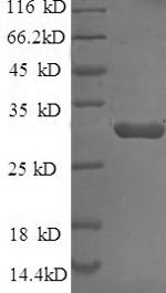 Greater than 90% as determined by SDS-PAGE.Recombinant E.Coli Beta-Lactamase Ctx-M-1 (BLA) Protein (His)