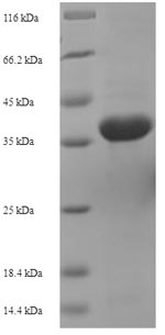 Greater than 90% as determined by SDS-PAGE.Recombinant Actinoplanes Utahensis Aculeacin-A Acylase (AAC) Protein (His-SUMO)