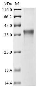 Greater than 85% as determined by SDS-PAGE.