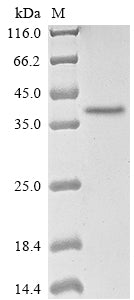 Greater than 85% as determined by SDS-PAGE.Recombinant Human Adenovirus B Serotype 11 Fiber Protein (L5) Protein (His)