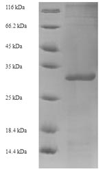Greater than 90% as determined by SDS-PAGE.Recombinant Human Papillomavirus Type 52 Protein E6 (E6) Protein (His-SUMO)