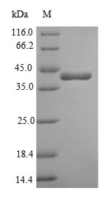 Greater than 90% as determined by SDS-PAGE.Recombinant Bacillus Subtilis Penicillin-Binding Protein 4 (PBPD) Protein (His-SUMO)