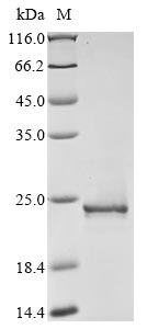 Greater than 90% as determined by SDS-PAGE.Recombinant Clostridium Symbiosum Pyruvate, Phosphate Dikinase (PPDK) Protein (His&Myc)