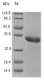 Greater than 90% as determined by SDS-PAGE.Recombinant Betula Pendula Profilin-1 (BETVII) Protein (His-SUMO)