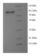 Greater than 90% as determined by SDS-PAGE.Recombinant Peptoclostridium Difficile Nad-Specific Glutamate Dehydrogenase (GLUD) Protein (His-SUMO)
