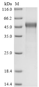 Greater than 90% as determined by SDS-PAGE.Recombinant Newcastle Disease Virus Hemagglutinin-Neuraminidase (HN) Protein (His)