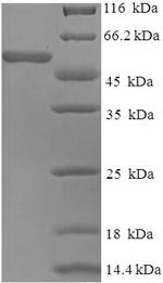 Greater than 90% as determined by SDS-PAGE.Recombinant Human Coronavirus Oc43 Spike Glycoprotein (S) Protein (His-SUMO)