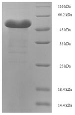 Greater than 90% as determined by SDS-PAGE.Recombinant Entamoeba Histolytica Pyruvate, Phosphate Dikinase (PPDK) Protein (His-SUMO)