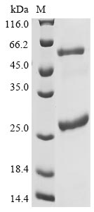 Greater than 90% as determined by SDS-PAGE.Recombinant Human Isoleucine--Trna Ligase, Cytoplasmic (IARS) Protein (His&Myc)