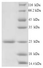 Greater than 90% as determined by SDS-PAGE.Recombinant Salmonella Typhimurium Protein Prgi (PRGI) Protein (His-SUMO)