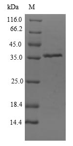Greater than 90% as determined by SDS-PAGE.Recombinant Citrobacter Freundii Dihydroxyacetone Kinase (DHAK) Protein (His-SUMO)