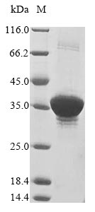 Greater than 85% as determined by SDS-PAGE.Recombinant E.Coli Fkbp-Type Peptidyl-Prolyl Cis-Trans Isomerase Fkpa (FKPA) Protein (His&Myc)