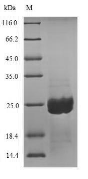 Greater than 90% as determined by SDS-PAGE.Recombinant Aspergillus Niger Aspergillopepsin-2ï¼ŒPartial Protein (His-SUMO)