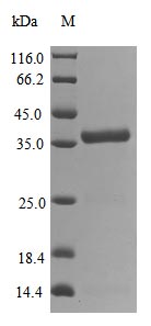 Greater than 85% as determined by SDS-PAGE.Recombinant Severe Acute Respiratory Syndrome Coronavirus 2 3C-Like Proteinase (NSP5) Protein (His)