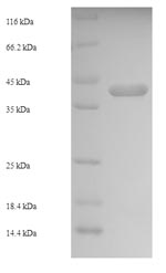 Greater than 90% as determined by SDS-PAGE.Recombinant Staphylococcus Aureus Enterotoxin Type C-2 (ENTC2) Protein (His-SUMO)