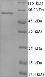 Greater than 90% as determined by SDS-PAGE.