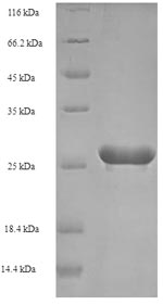 Greater than 90% as determined by SDS-PAGE.Recombinant Human Papillomavirus Type 52 Protein E7 (E7) Protein (His-SUMO)