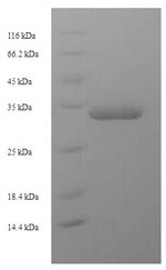 Greater than 90% as determined by SDS-PAGE.Recombinant E.Coli Universal Stress Protein F (USPF) Protein (His-SUMO)