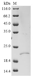 Greater than 90% as determined by SDS-PAGE.Recombinant Severe Acute Respiratory Syndrome Coronavirus 2 Envelope Small Membrane Protein & Membrane Protein (E & M) Protein (His-SUMO)