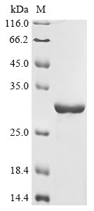 Greater than 90% as determined by SDS-PAGE.Recombinant Junin Mammarenavirus Pre-Glycoprotein Polyprotein Gp Complex (GPC) Protein (His&Myc)