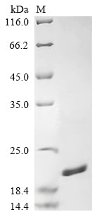 Greater than 90% as determined by SDS-PAGE.Recombinant Legionella Pneumophila Peptidoglycan-Associated Lipoprotein (PAL)