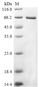 Greater than 85% as determined by SDS-PAGE.Biotinylated Recombinant Chicken Lysozyme G, Biotinylated Protein (MBP&His-Avi)