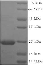 Greater than 90% as determined by SDS-PAGE.Recombinant Onchocerca Volvulus Ov-16 Antigen (OV16) Protein (His)