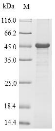 Greater than 90% as determined by SDS-PAGE.Recombinant Mouse Troponin I, Cardiac Muscle (TNNI3) Protein (His-SUMO)
