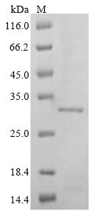 Greater than 85% as determined by SDS-PAGE.Recombinant Mouse Troponin I, Cardiac Muscle (TNNI3)