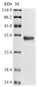 Greater than 85% as determined by SDS-PAGE.