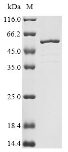 Greater than 85% as determined by SDS-PAGE.Recombinant Rat Troponin T, Cardiac Muscle (TNNT2) Protein (His)