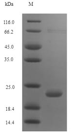 Greater than 90% as determined by SDS-PAGE.