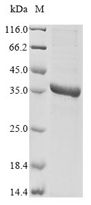 Greater than 85% as determined by SDS-PAGE.Recombinant Human Herpesvirus 6A Triplex Capsid Protein 1 (TRX1) Protein (His)