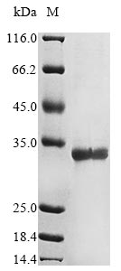 Greater than 85% as determined by SDS-PAGE.Recombinant Human Herpesvirus 6B Mrna Export Factor Icp27 Homolog (KA3L) Protein (His&Myc)