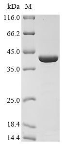 Greater than 90% as determined by SDS-PAGE.Recombinant Leptospira Interrogans Serogroup Icterohaemorrhagiae Serovar Lai Sphingomyelinase C 2 (SPH2) Protein (His&Myc)