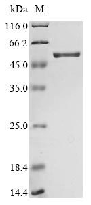 Greater than 85% as determined by SDS-PAGE.Recombinant Human Sars Coronavirus Nucleoprotein (N) Protein (His)